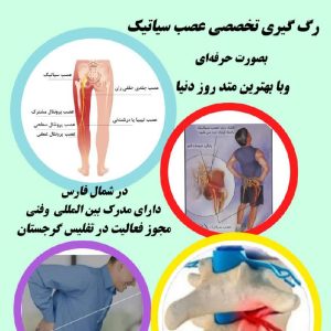رگ‌گیری عصب سیاتیک بصورت کاملا حرفه ای